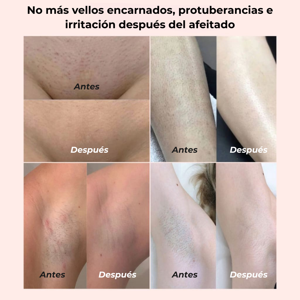 Suaveza 2.0 - Bikini Shaver