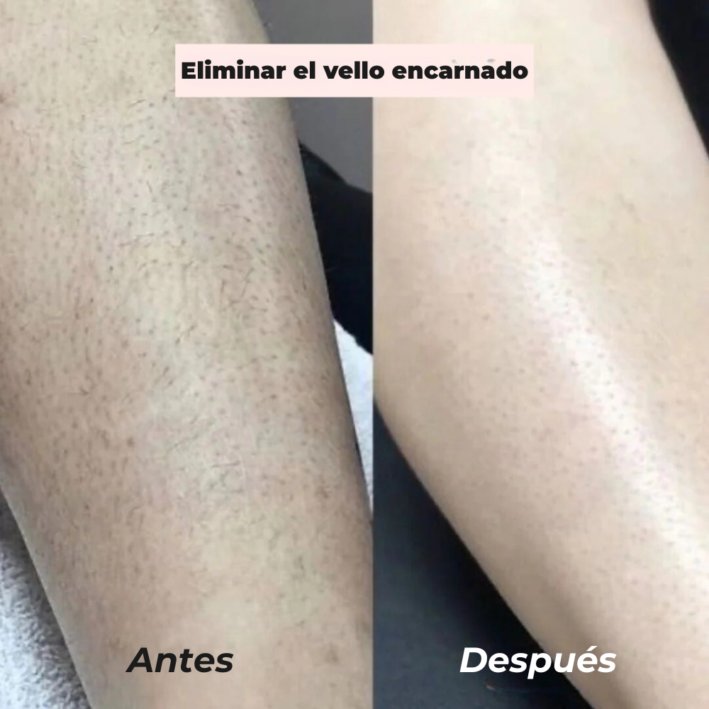 Suaveza 2.0 - Bikini Shaver